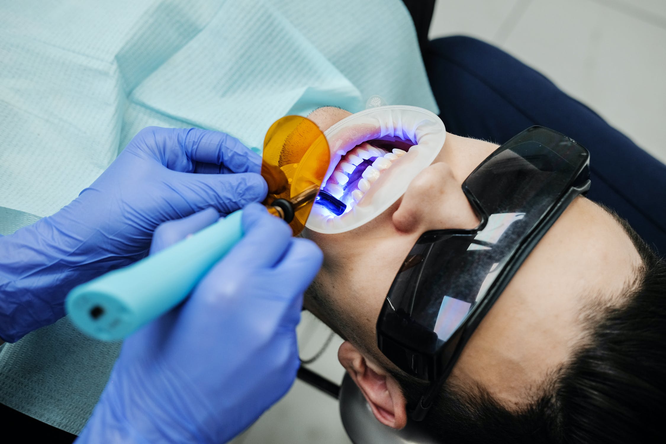 Five reasons to go for cosmetic dentistry