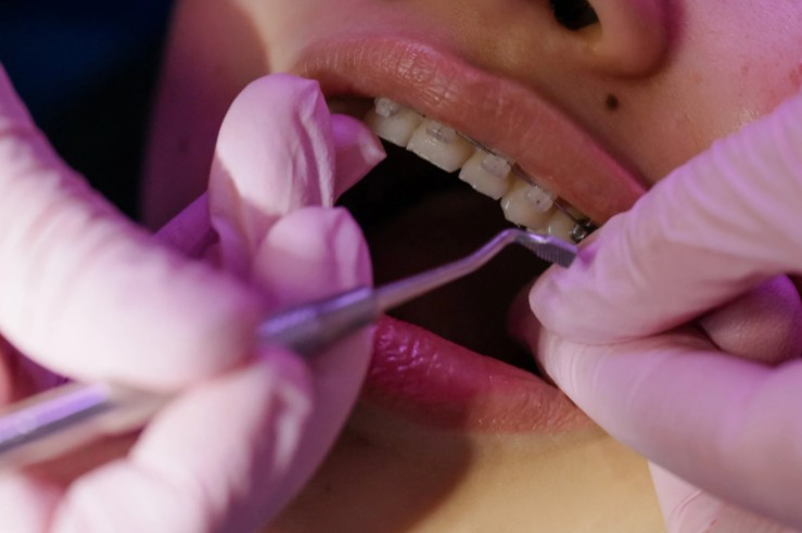 What Procedures Do Orthodontists Perform?